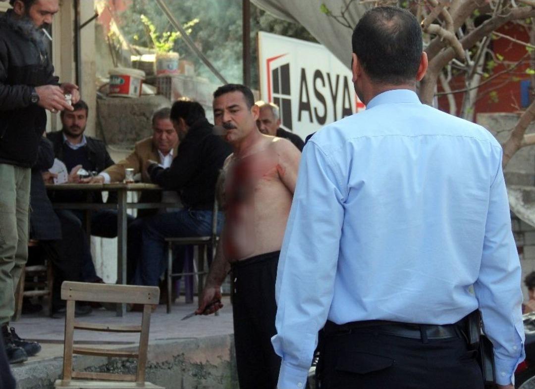 Hem Kendini Kesti Hem T&uuml;rk Kahvesi İ&ccedil;ti