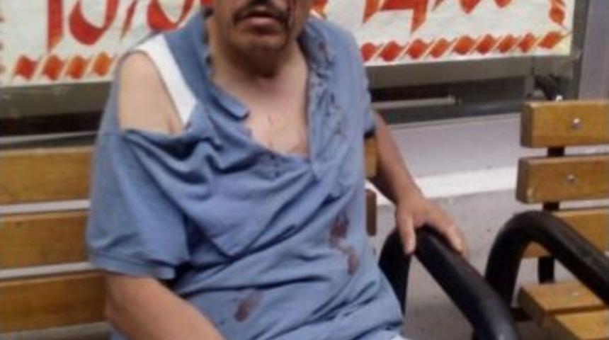 Akciğer Kanseri Adam Oğluyla Gittiği Markette Darp Edildi