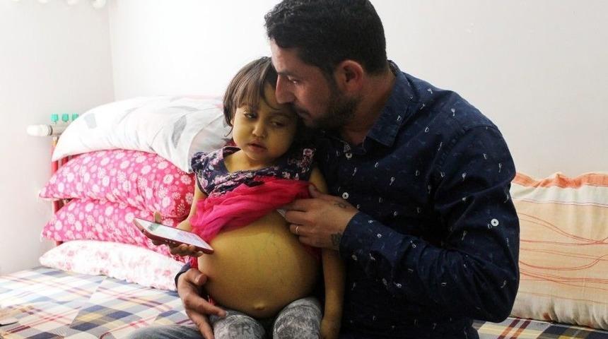 (özel) Minik Asel Türk Vatandaşı Olamazsa Hayatını Kaybedebilir