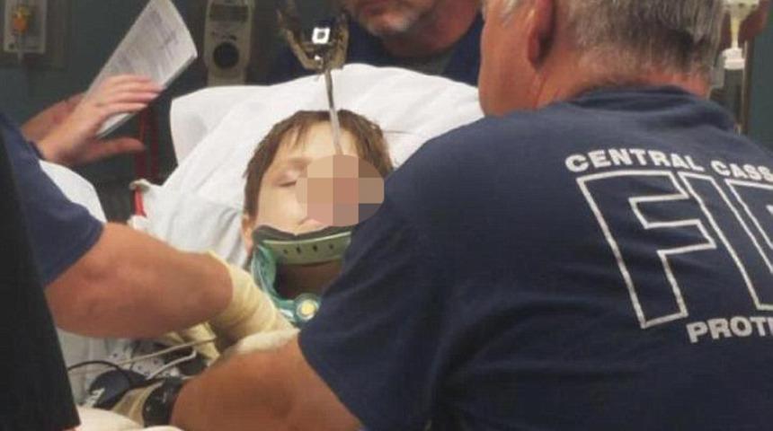 Korkunç olay! Arılardan kaçan çocuğun kafasına şiş saplandı