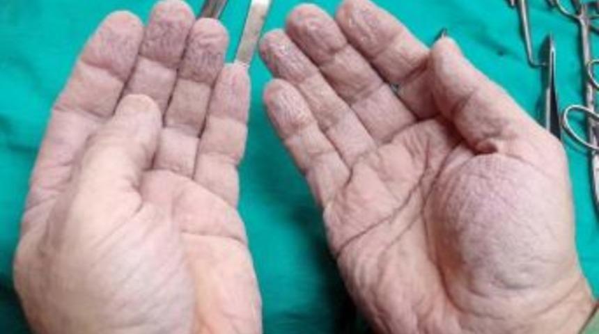 Cerrahın Elleri Sosyal Medyayı Salladı