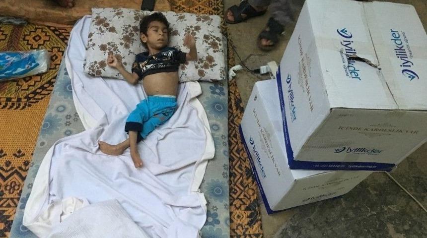 Suriyeli K&uuml;&ccedil;&uuml;k &Ouml;mer T&uuml;rkiye&rsquo;de Sağlığına Kavuşacak