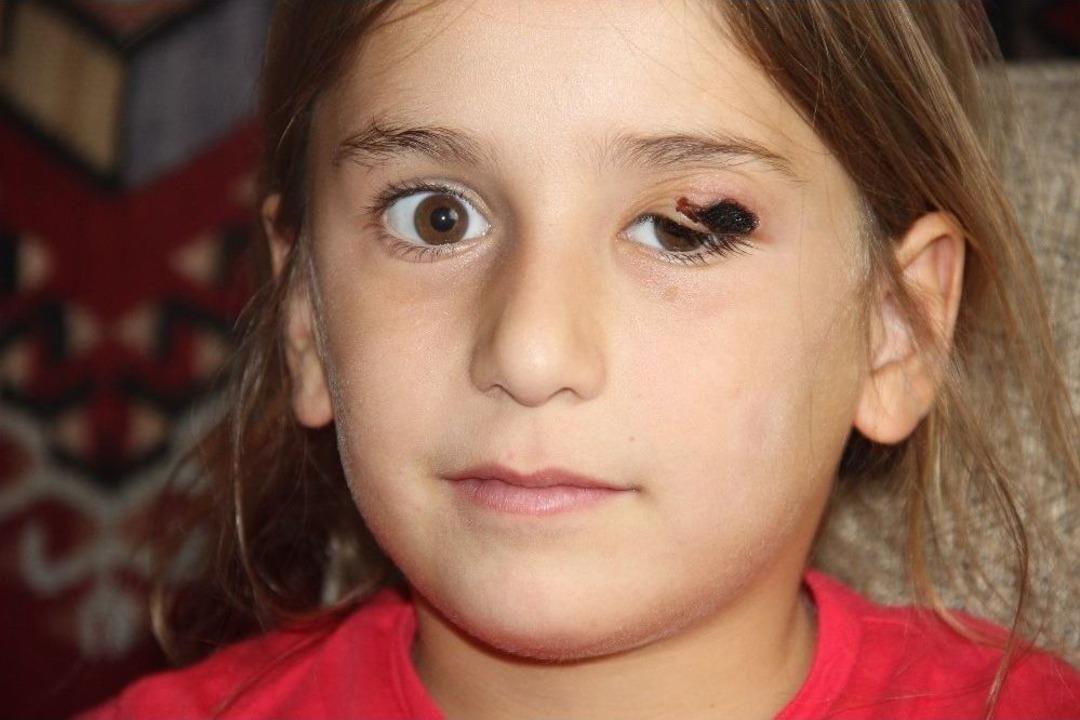 Sivas&rsquo;ta Şarbon Ş&uuml;phesiyle K&ouml;yde Panik