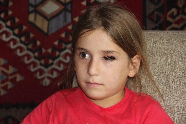 Sivas’ta Şarbon Şüphesiyle Köyde Panik G1