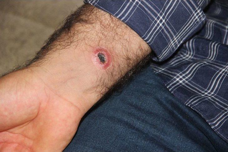 Sivas’ta Şarbon Şüphesiyle Köyde Panik G3