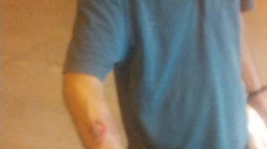 Evinden &Ccedil;ıkarken 6 K&ouml;peğin Saldırısına Uğrayan Adam Hastanelik Oldu