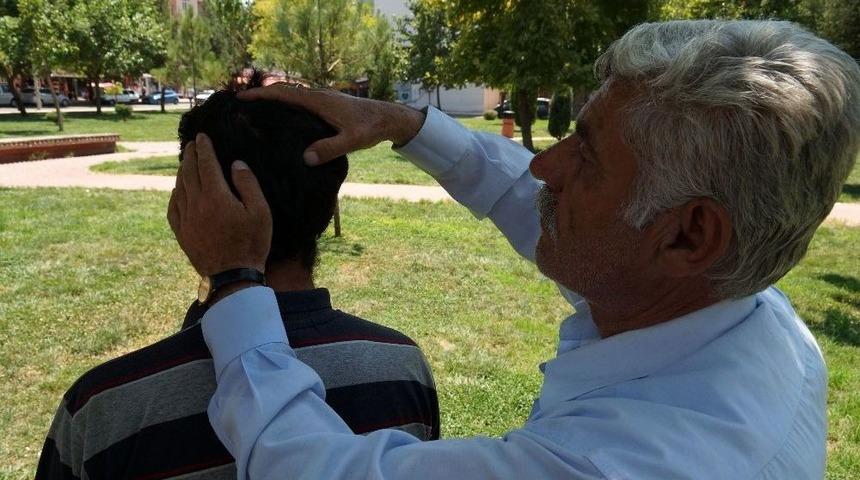 (&ouml;zel) Başındaki 80 Sa&ccedil;mayla 12 Yıldır Yaşıyor