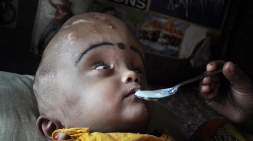 Tıp d&uuml;nyasını yanıltan mucize!