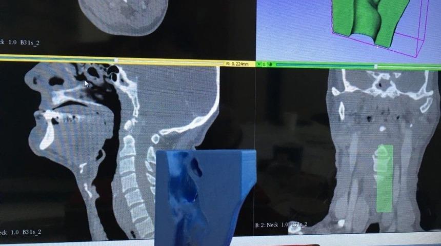 Sd&uuml;&rsquo;den Sağlık Alanında Yenilik&ccedil;i &Ccedil;alışma