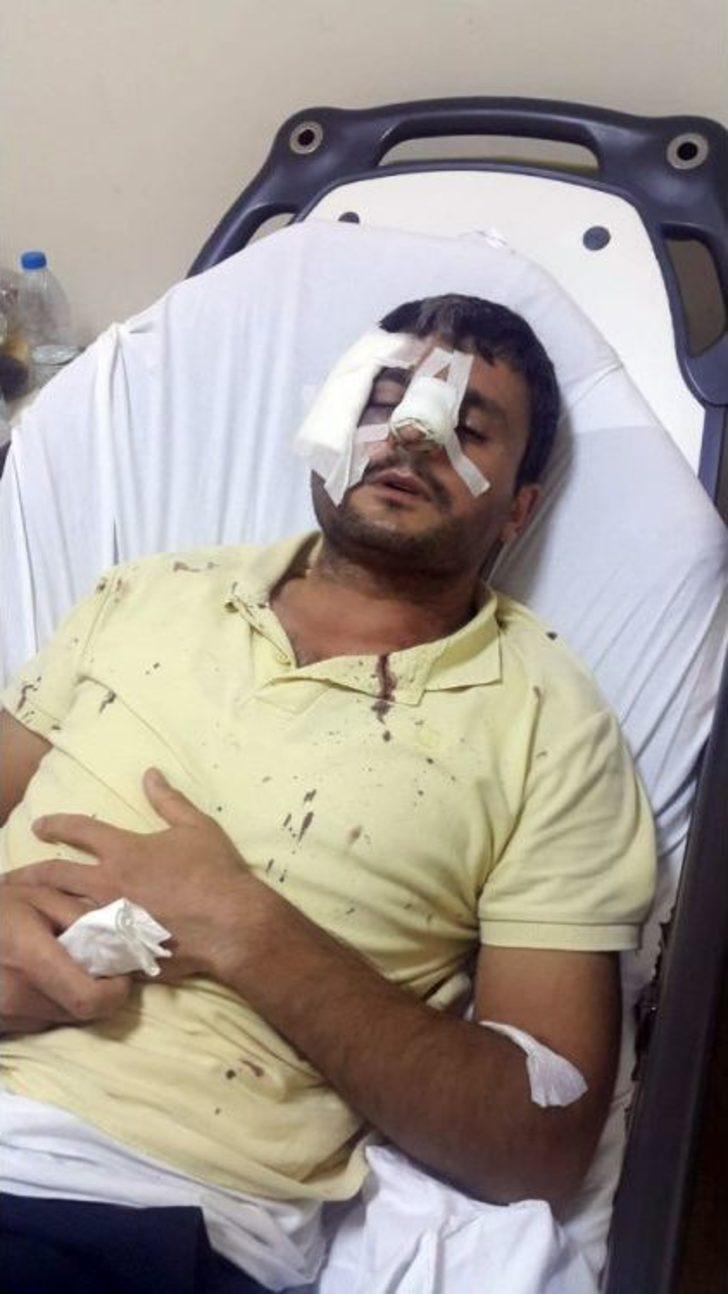 Sudan Uyruklu Alkollü Genç, Dehşet Saçtı G3