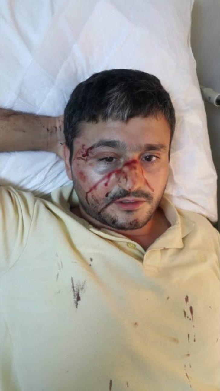 Sudan Uyruklu Alkollü Genç, Dehşet Saçtı G4