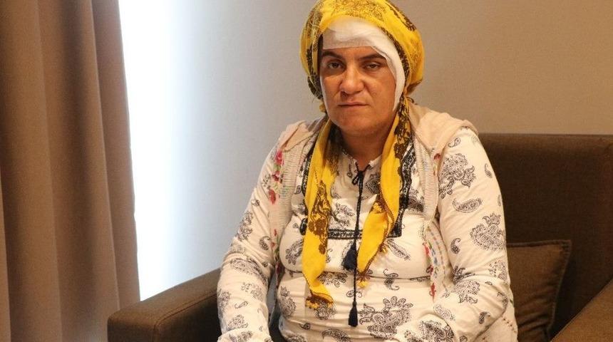 &rsquo;hamilelikten G&ouml;zlerin G&ouml;rm&uuml;yordur&rsquo; Denilen Kadının Beyninde T&uuml;m&ouml;r &Ccedil;ıktı