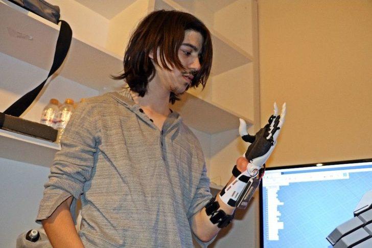 Balkonda Yaptığı Deneyle İki Elini Ve Gözünü Kaybetti, Bilim Dünyasına Yeniden Döndü G1