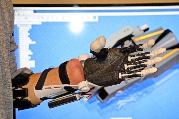 Balkonda Yaptığı Deneyle İki Elini Ve Gözünü Kaybetti, Bilim Dünyasına Yeniden Döndü G2