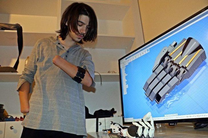 Balkonda Yaptığı Deneyle İki Elini Ve Gözünü Kaybetti, Bilim Dünyasına Yeniden Döndü G4