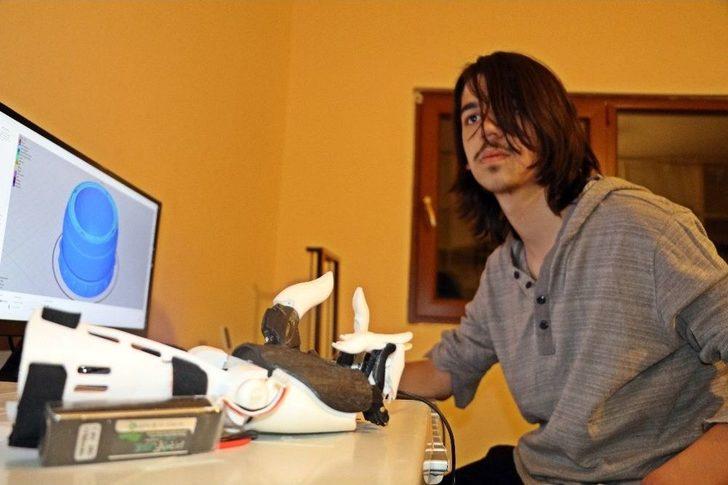 Balkonda Yaptığı Deneyle İki Elini Ve Gözünü Kaybetti, Bilim Dünyasına Yeniden Döndü G5