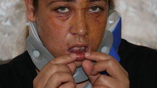 çamaşırları Kirletmeyin Diye Uyardı, Öldüresiye Dövüldü