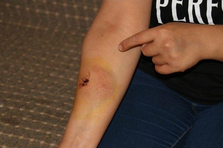 "çamaşırları Kirletmeyin" Diye Uyardı, Öldüresiye Dövüldü G1