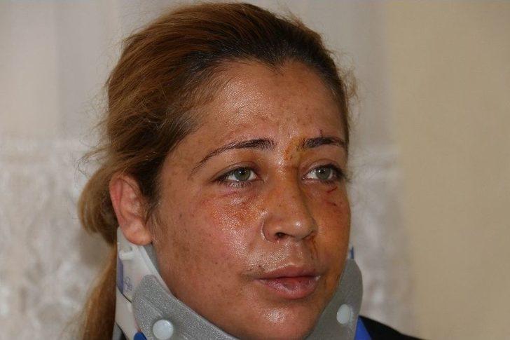 "çamaşırları Kirletmeyin" Diye Uyardı, Öldüresiye Dövüldü G3