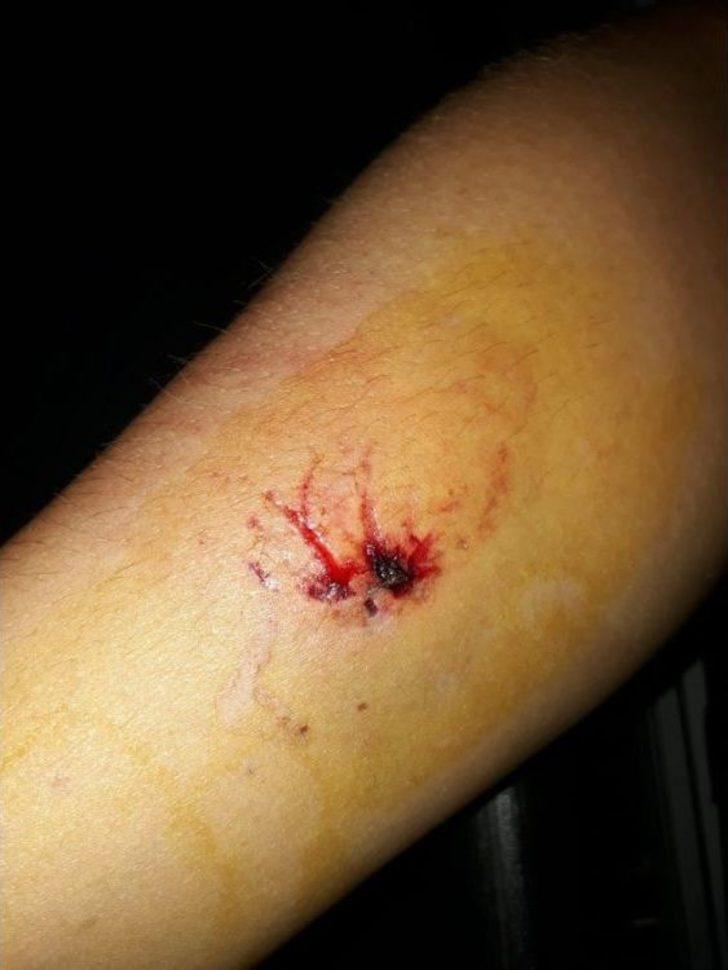 "çamaşırları Kirletmeyin" Diye Uyardı, Öldüresiye Dövüldü G5