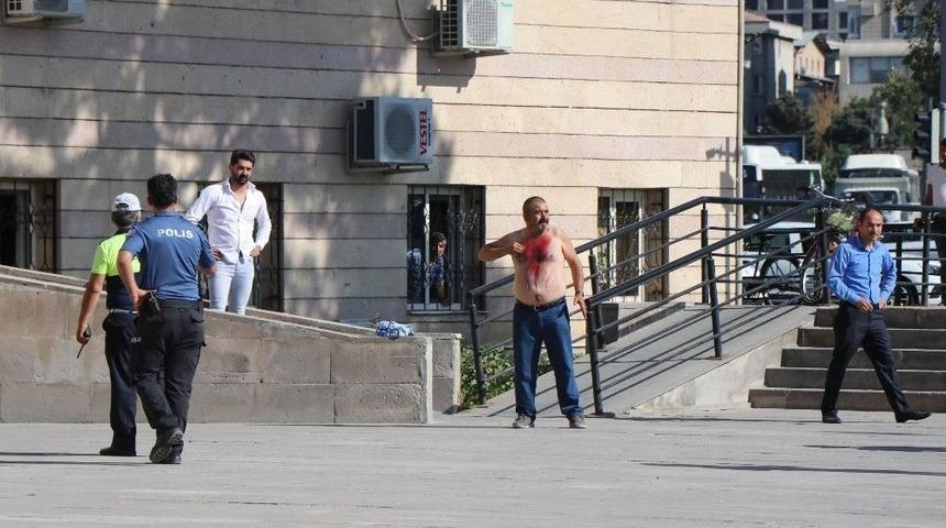 Yardım Alabilmek İ&ccedil;in Kendini Kesti