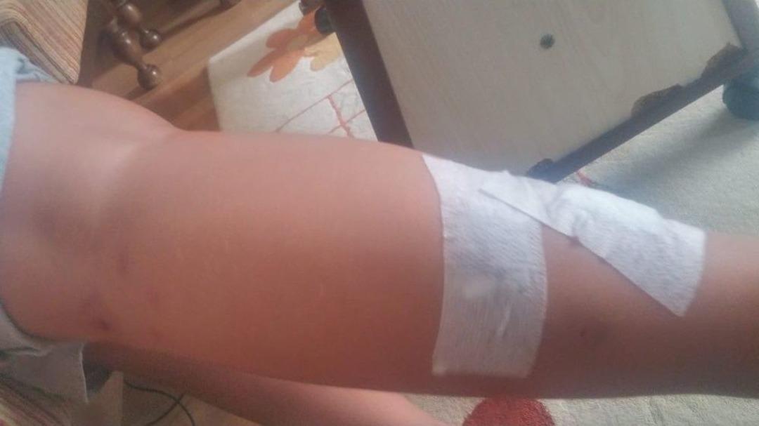 İneg&ouml;l&rsquo;de Başı Boş K&ouml;pekler Dehşet Sa&ccedil;maya Devam Ediyor