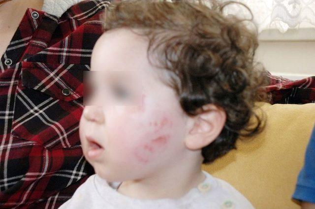 1,5 Yaşındaki Bebeğin Kreşte Darp Edildiği İddiası 2
