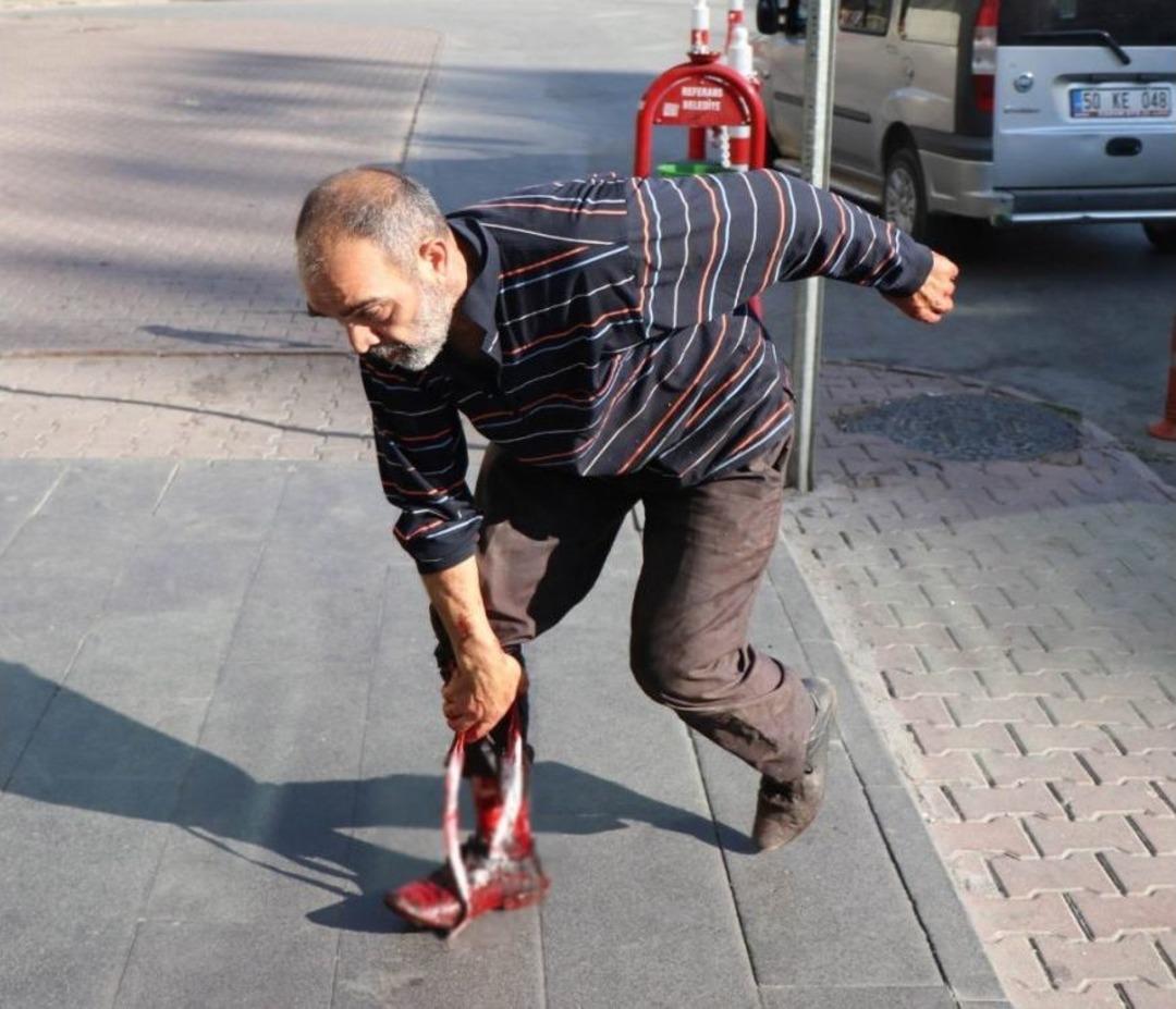 Kayseri&rsquo;de Acemi Kasaplar Hastanelere Akın Etti