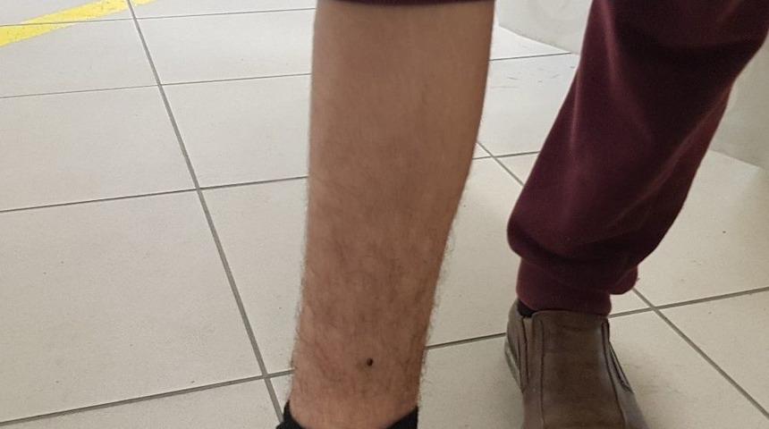 Kurban Kesilirken Ayağına &rsquo;kene&rsquo; Yapıştı