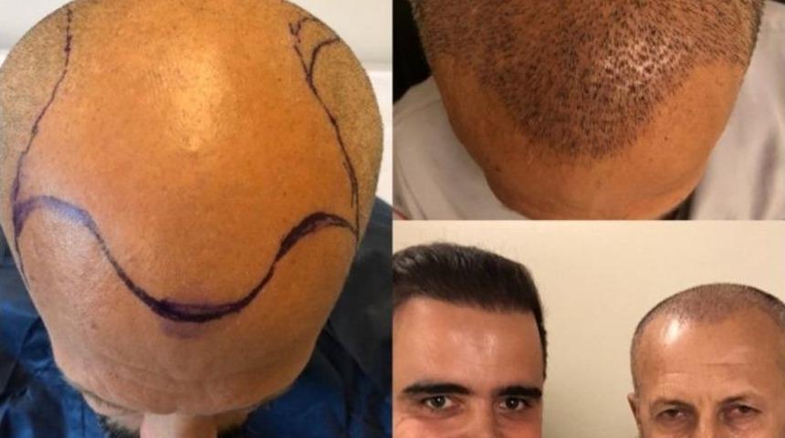 Kaybolan Yıllarına Bir Haftada Kavuştu