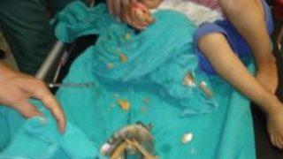 3 Yaşındaki Çocuğun Eli Kıyma Makinesine Sıkıştı