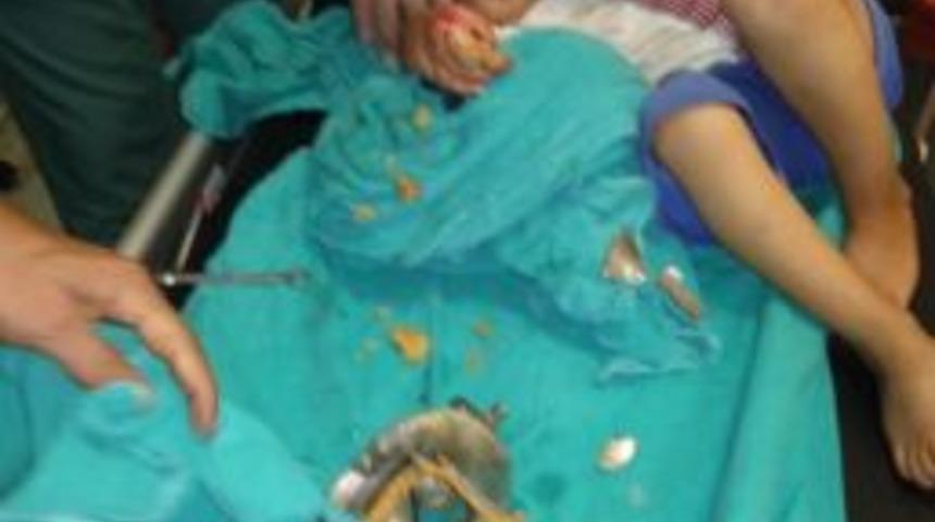 3 Yaşındaki Çocuğun Eli Kıyma Makinesine Sıkıştı