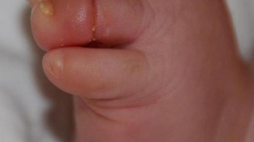 Annesinin Sa&ccedil;ı Az Daha 3 Aylık Bebeği Parmağından Edecekti