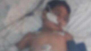 Küçük Çocuğun Üstüne İnşaattan Beton Parçası Düştü