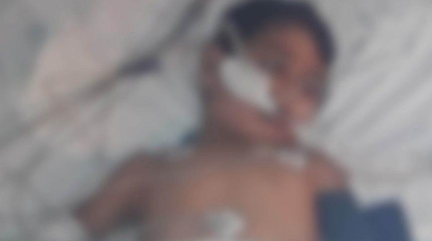 Küçük Çocuğun Üstüne İnşaattan Beton Parçası Düştü