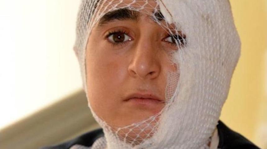 Yatılı &Ouml;ğrenci G&ouml;mleğini Yıkamak İsterken Kendini Yaktı