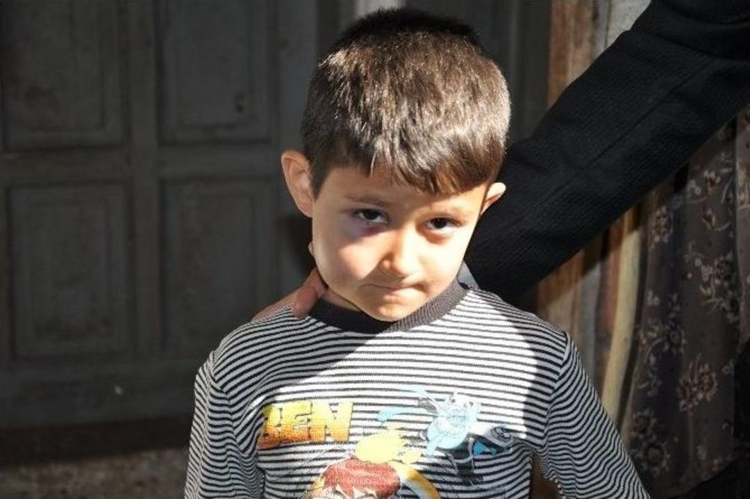 Kazada Yaralanan &Ouml;ğrencilere Psikolojik Destek