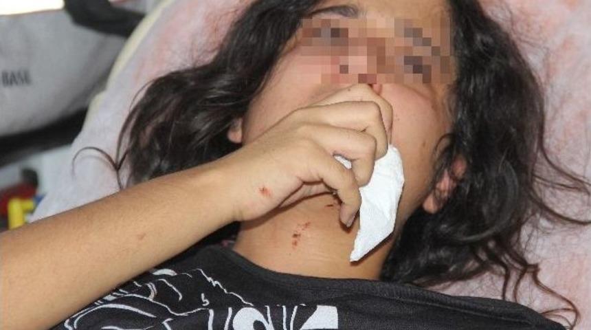 (özel Haber) Annesinin Arkadaşı Burnunu Kırdı