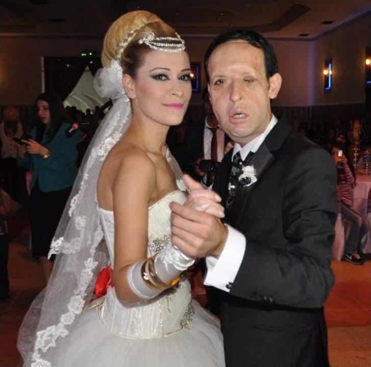 Yüz Nakilli Recep Sert'in Düğünü Öncesi Kına Gecesinde Mutluluk Gözyaşları (2)