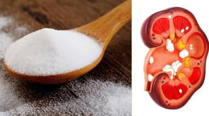 1 Çay Kaşığı Karbonat ile Böbreklerinizi Tedavi Edin