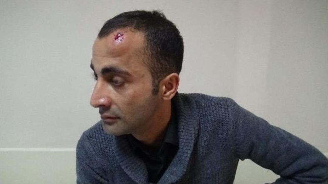 Eğitim-sen Y&uuml;r&uuml;y&uuml;ş&uuml;ne M&uuml;dahale: 7 Yaralı