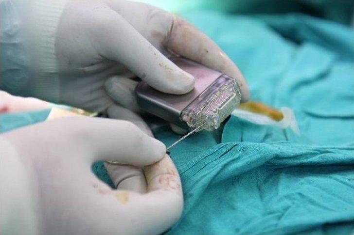 27 Yıllık Titreme, Beyin Piliyle Sona Erdi G3