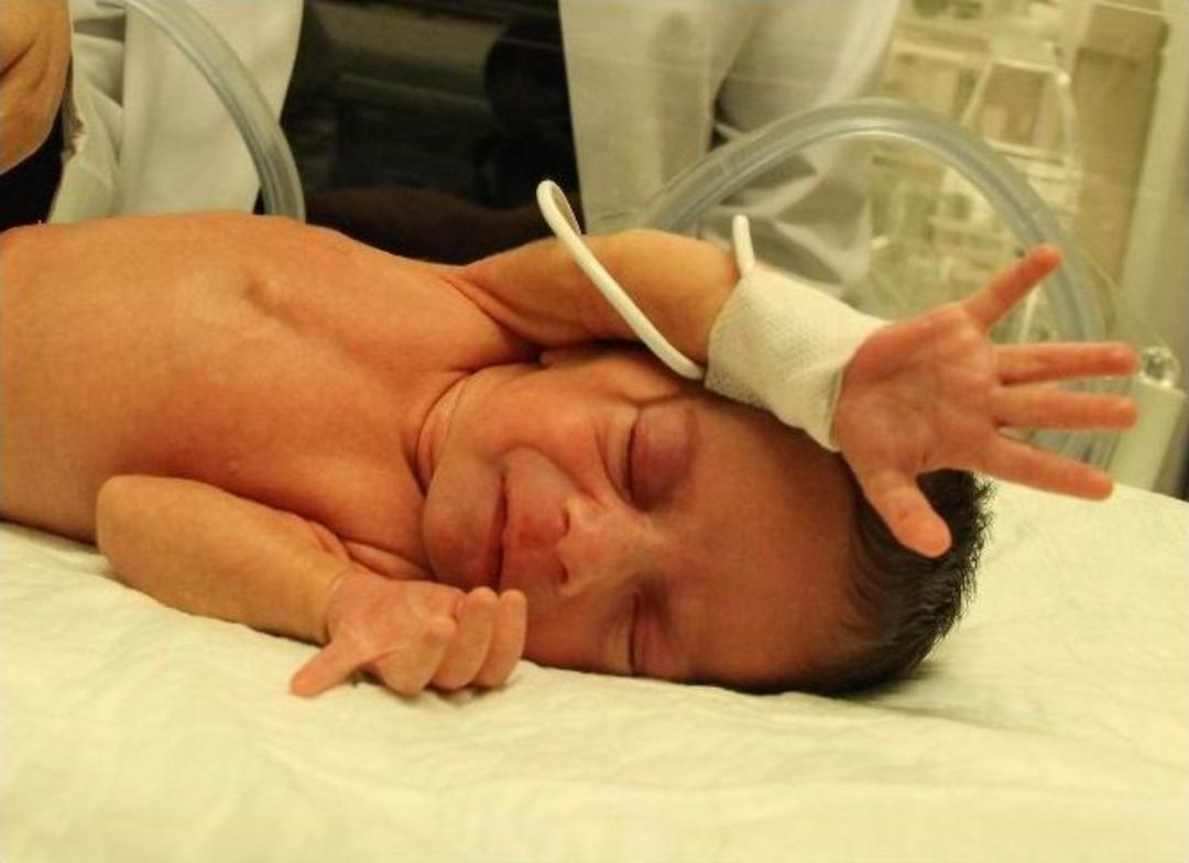 (&ouml;zel Haber) İlklerin Bebeği &rsquo;almina&rsquo; Oldu