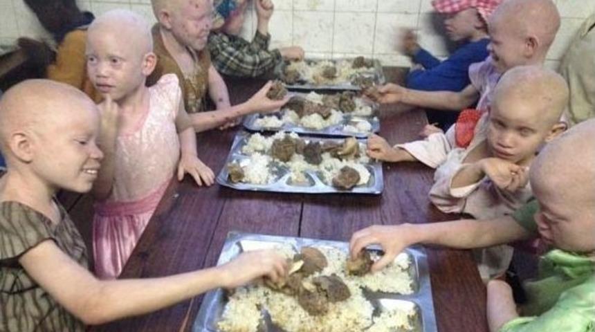 Burhaniye Belediyesi Tanzanya&rsquo;daki "albino K&ouml;y&uuml;"ne Destek Olacak