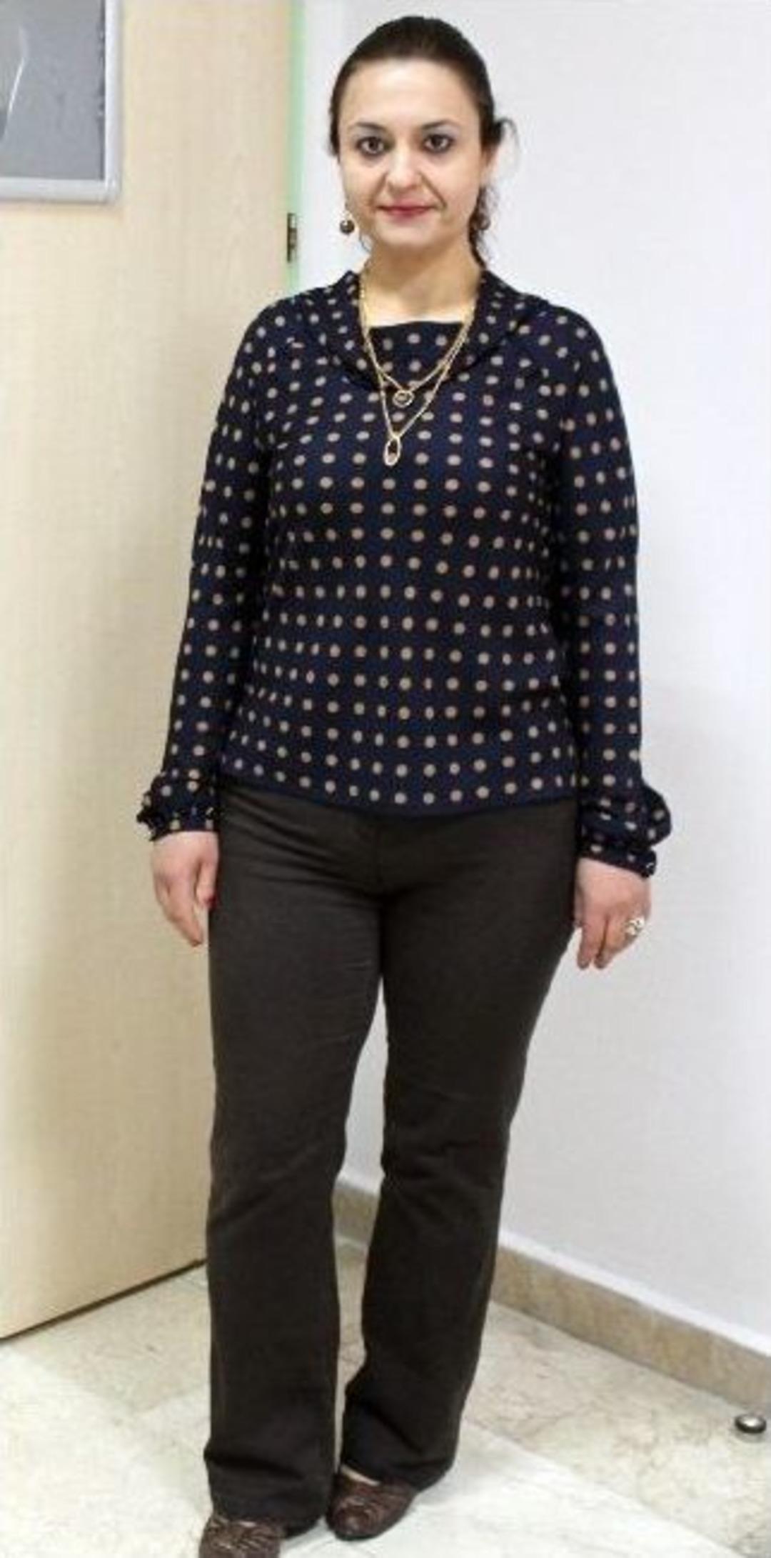 T&uuml;p Mide Ameliyatı İle Zayıflayanlar Bir Araya Geldi