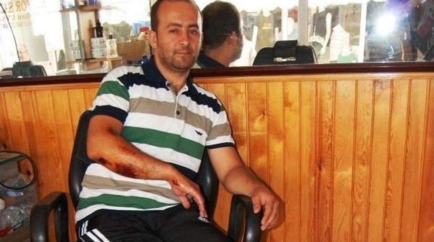 Evine Giderken K&ouml;peklerin Saldırısına Uğradı