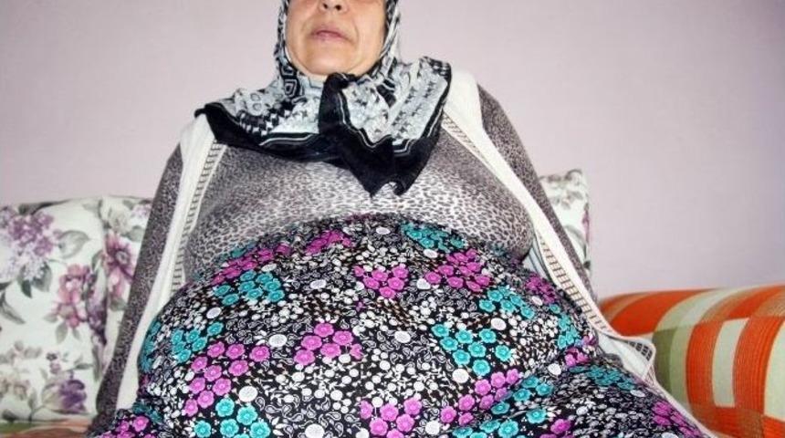 (&ouml;zel Haber) Bağırsakları Dışarıda Geziyor