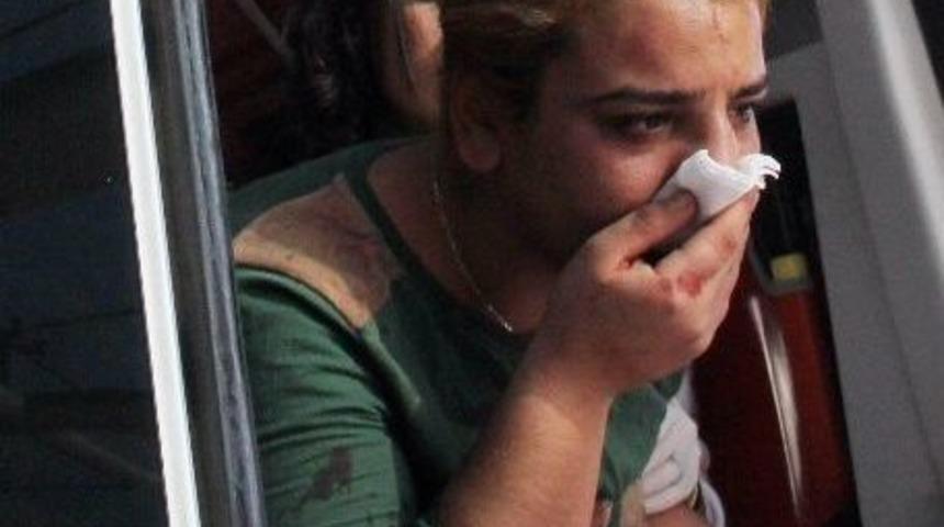 (&ouml;zel Haber) Kayınbabası Burnunu Kırdı