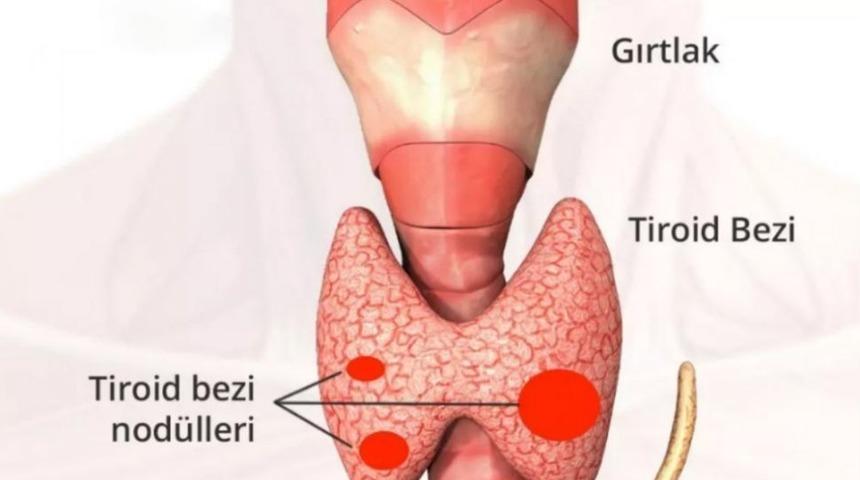 Hızlı Kilo Değişimi Tiroidden Olabilir