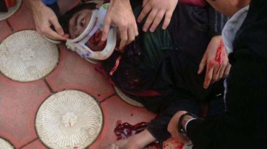 Ev Sahibiyle Karşılaşan Hırsız 5'inci Kattan Atlayınca Yaralandı